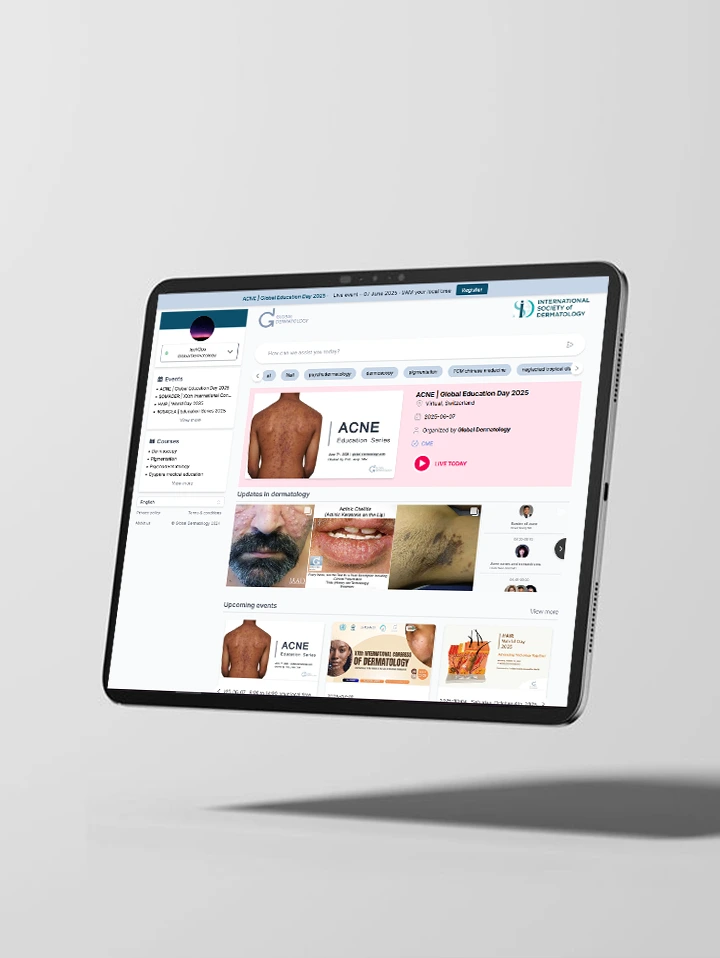 Global Dermatology